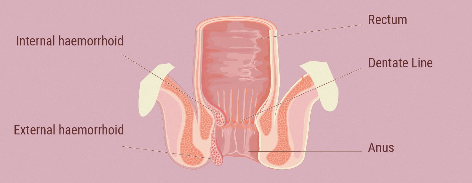 The Link Between the ECS and Haemorrhoids The Link Between the ECS and Haemorrhoids