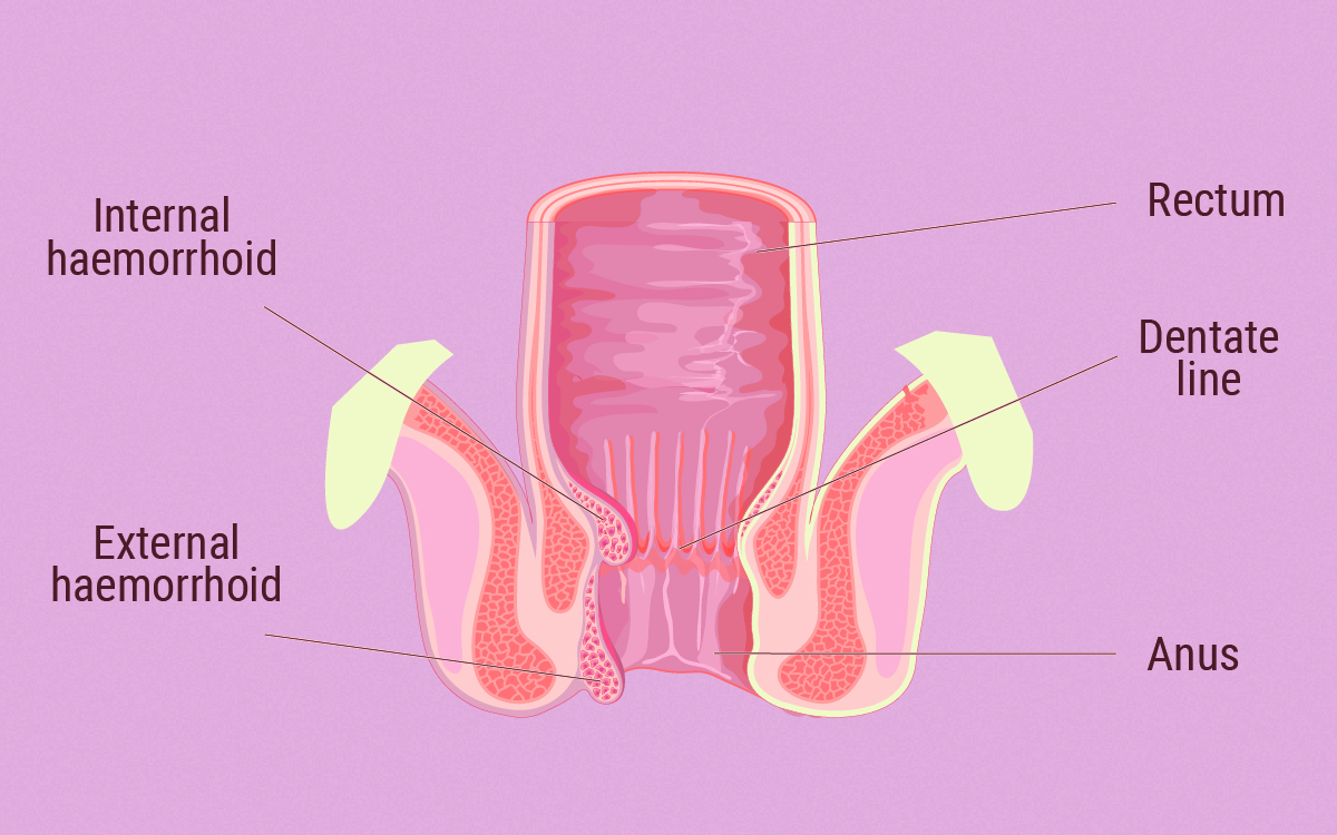 The Link Between the ECS and Haemorrhoids The Link Between the ECS and Haemorrhoids