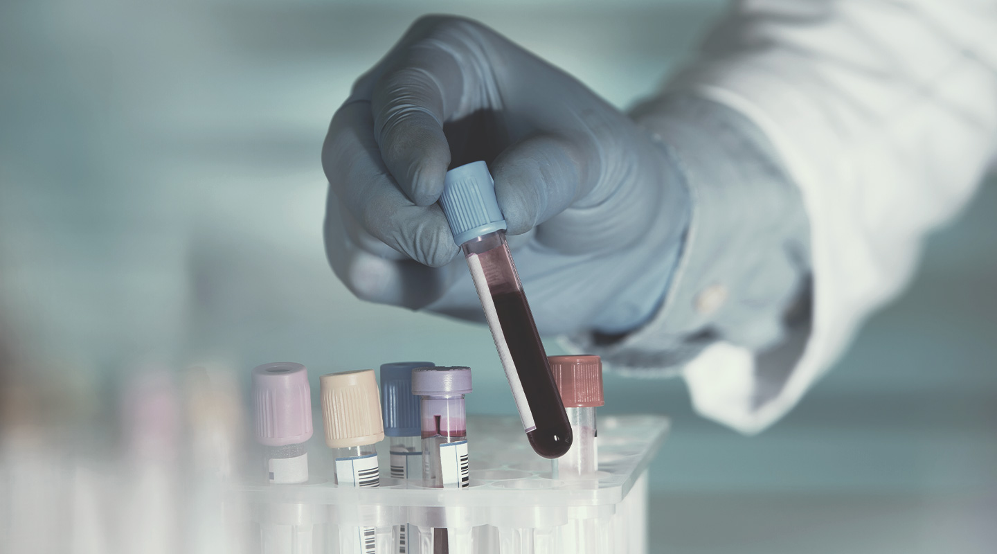 Blood Testing Blood Testing