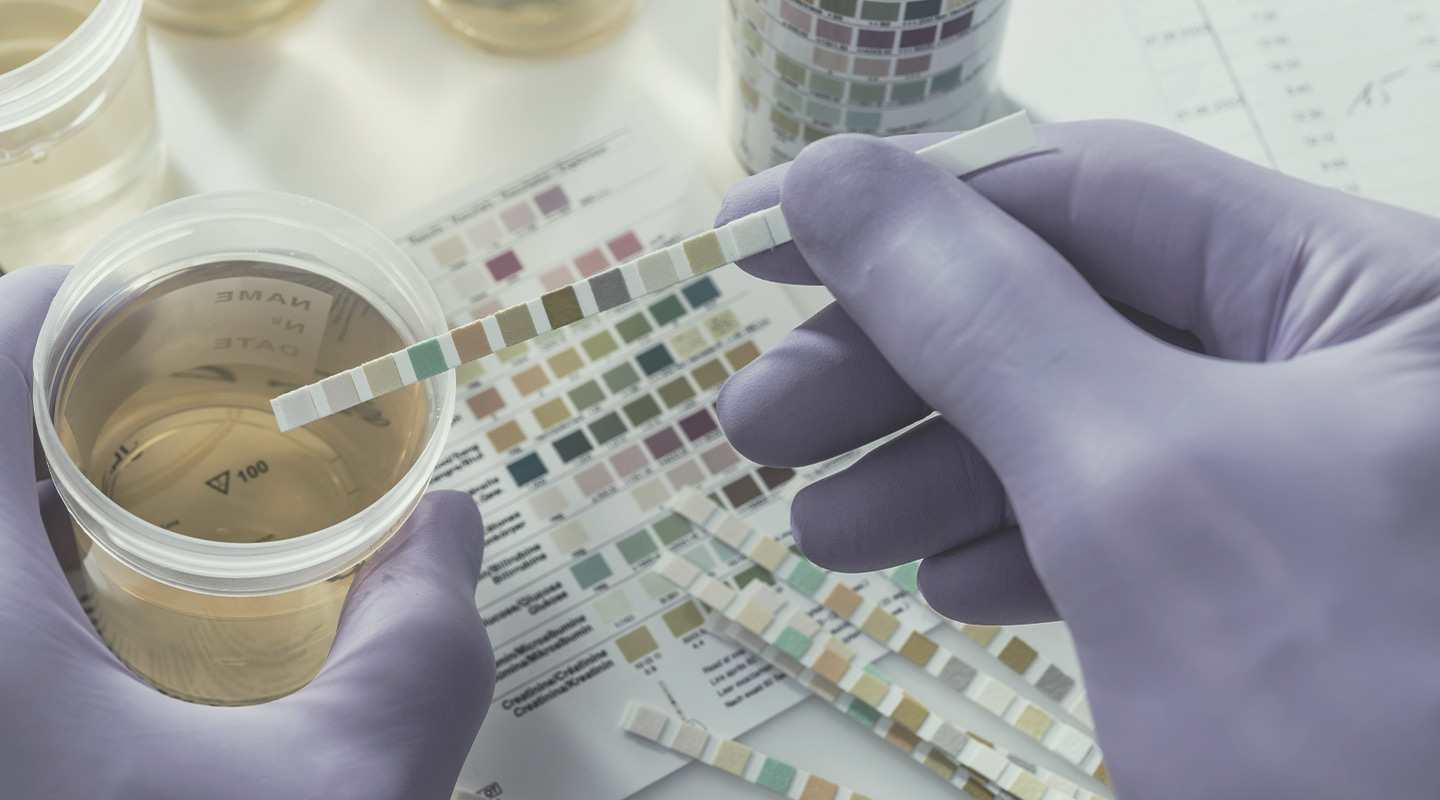 Urine Testing Urine Testing